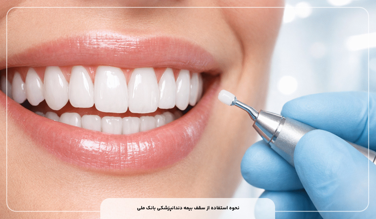 سقف بیمه دندانپزشکی بانک ملی چقدر است؟